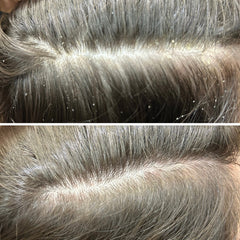 5 Signs Your Scalp Needs Exfoliation (Most People Miss #3)